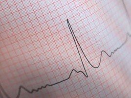 EKG Nedir?